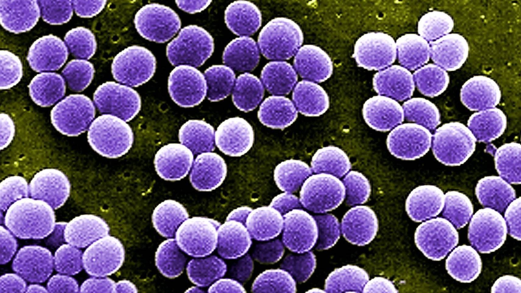 Staphylococcus aureus Staphylococcus aureus